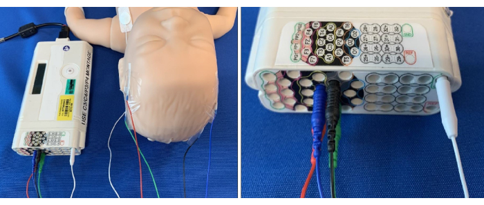 figure-results-4 Infant EEG monitoring setup; electrodes and device for brain activity measurement in neonatal study.