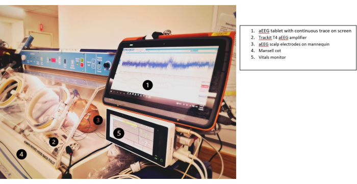 figure-results-8 aEEG monitoring setup with trace display, electrodes on mannequin, Trackit T4 amplifier, and vitals monitor.