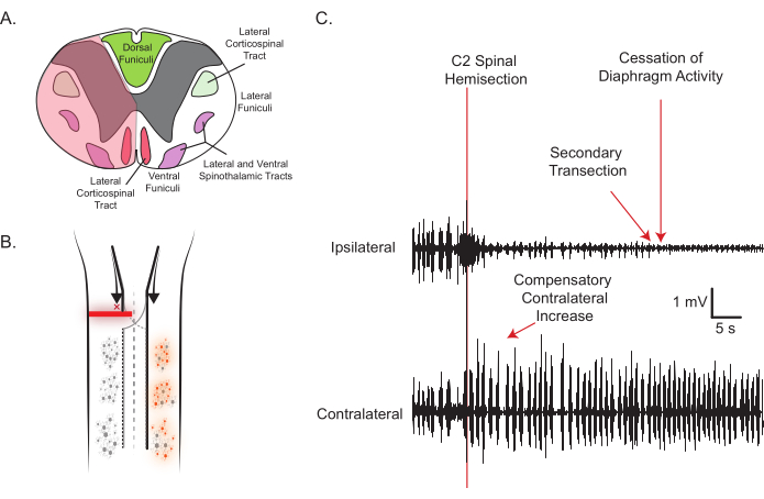 Spinal cord diagram, spinal hemisection process, neurophysiological experiment, waveform data.