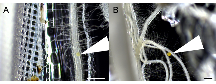 figure-results-1 Microscope image of plant root structures with arrow highlighting nodules; diagram of plant anatomy.