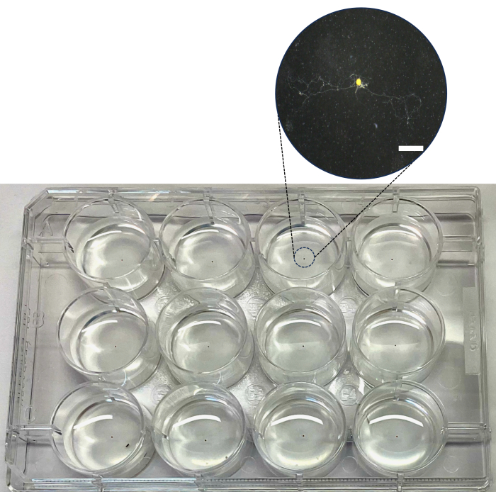 figure-results-3 Cell culture plate with magnified image of neural cell growth in a microscope, scientific research.