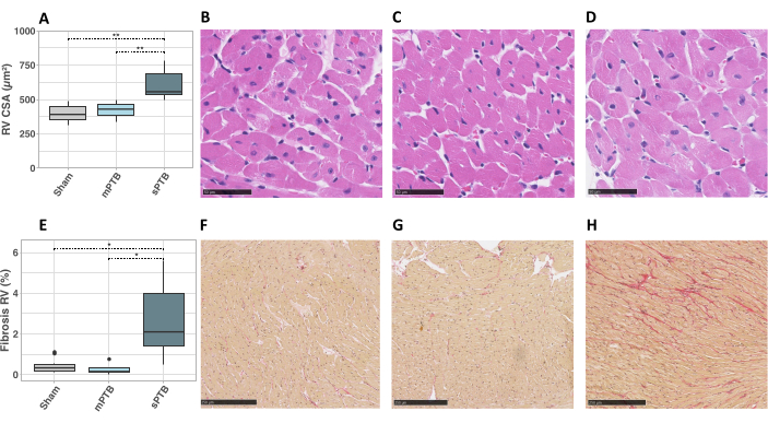 Heart tissue analysis; histology slides, fibrosis and CSA data; microscopy and statistical charts.