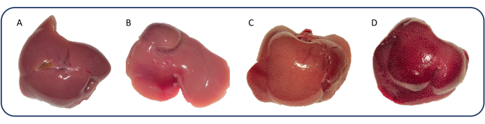 Liver morphology comparison diagram showing four different stages labeled A to D for pathology study.