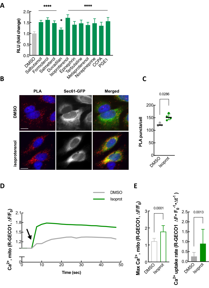 figure-results-4 Bar graph showing RLU fold change, microscopy images with PLA and Sec61-GFP, calcium measurement.