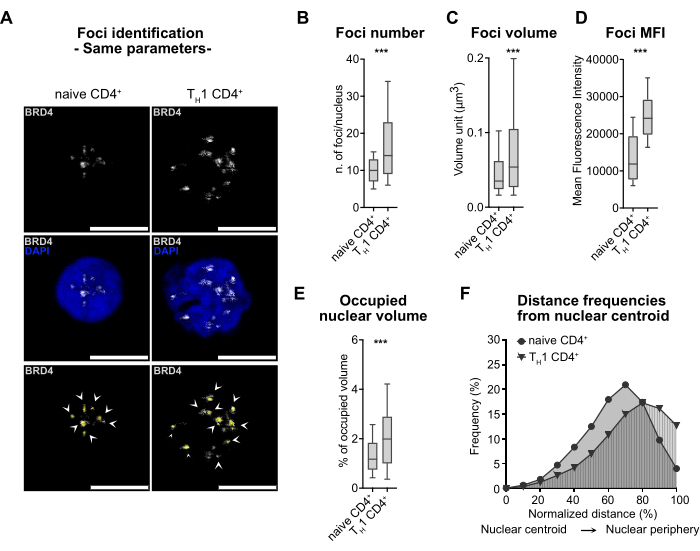 figure-results-3 BRD4 foci identification; fluorescence microscopy, box plots, nuclear volume, distance graph analysis.