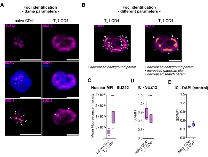 figure-results-4 Foci identification; SUZ12 protein analysis; fluorescence microscopy; nuclear intensity comparison.