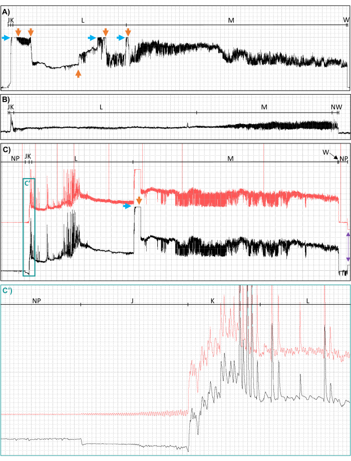 Electrophysiology graph showing neural activity data analysis with labeled peaks and transitions.