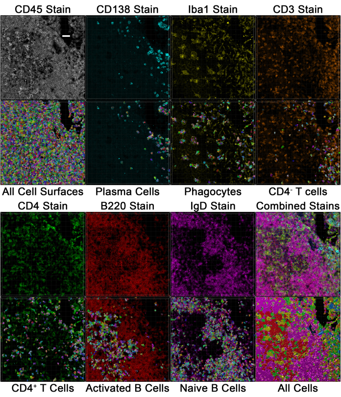 Immunofluorescence microscopy, cell staining, CD45, CD138, Iba1, CD3, CD4, B220, IgD, composite.