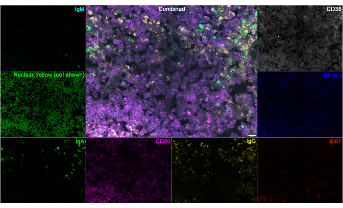 Immunofluorescence microscopy panel showing IgM, IgA, CD20, IgG, Ki67 markers; cell type analysis.