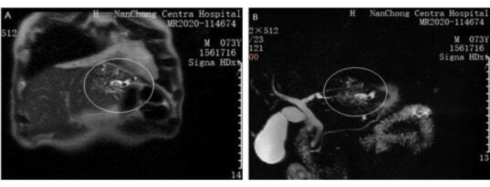 Brain MRI scan showing anatomical details and diagnostic areas of interest in medical imaging.