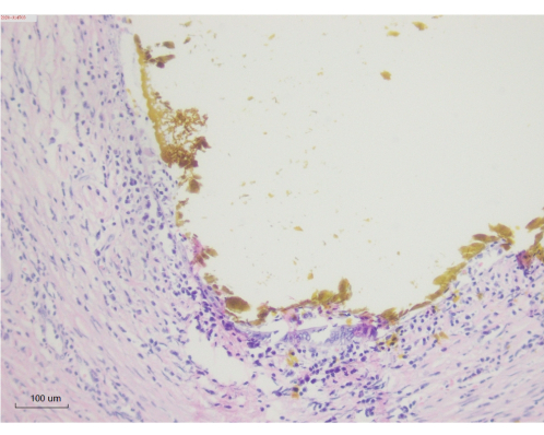Histological tissue section, stained cells, microscope image, pathology analysis.
