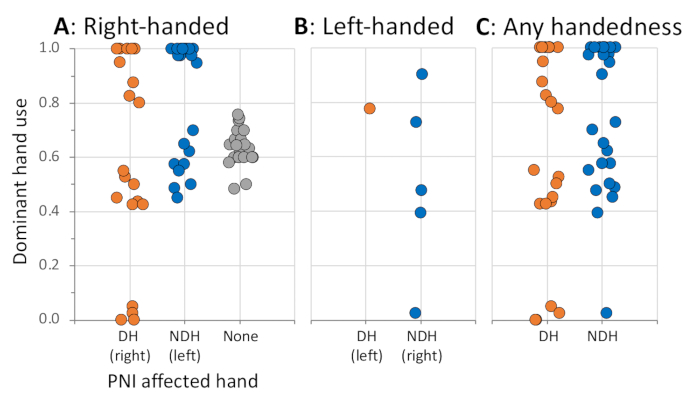 Hand dominance graph; right vs left-handed PNI impact; dominant hand use; scatter plot data analysis.