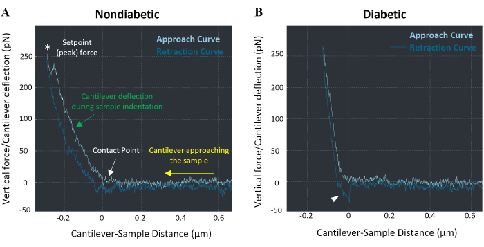 figure-results-4 Atomic force microscopy curves for nondiabetic and diabetic samples, showing force vs. distance.