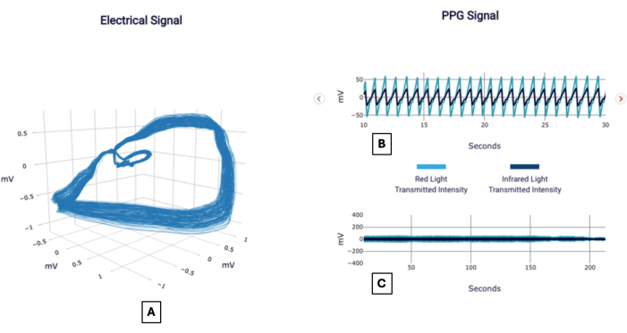 Electrical vs. PPG signal analysis; graph comparing electrical and photoplethysmogram signals.