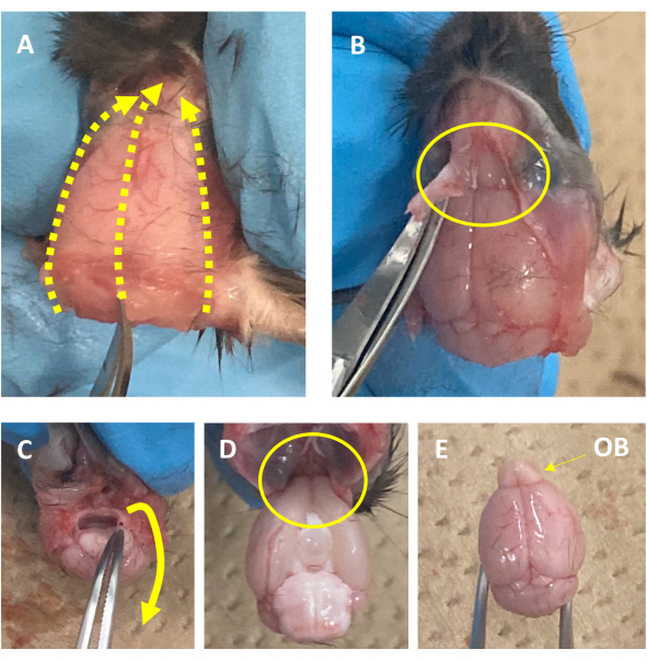 figure-results-2 Olfactory bulb dissection process, step-by-step anatomy diagram, neuroscience study method.