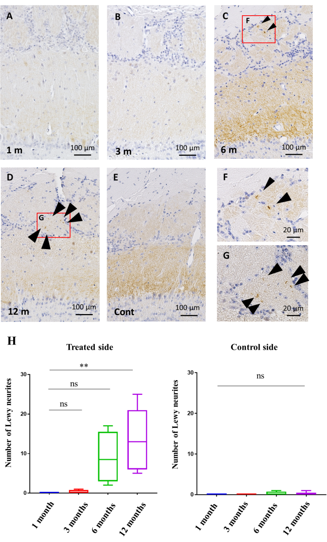 figure-results-3 Static equilibrium analysis; histological sections, Lewy neurites in treatment/control, microscopy.