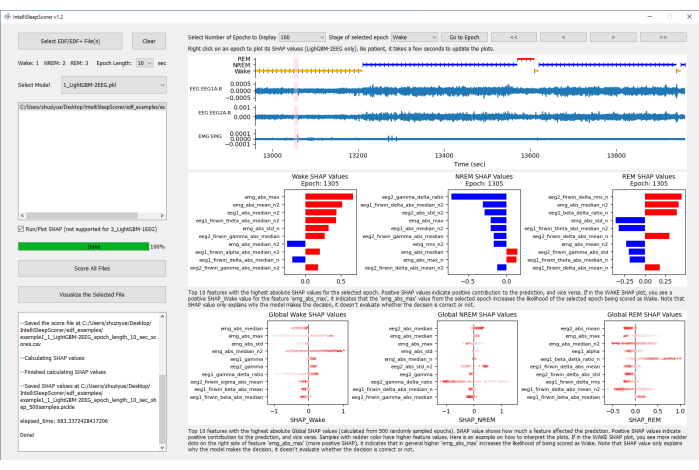 EEG signal analysis diagram with SHAP values for sleep stage classification.