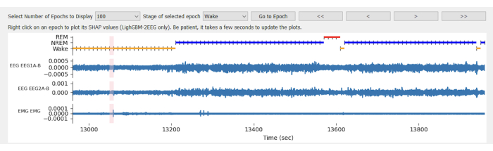 EEG-EMG graph displaying brain activity stages: REM, NREM, wake; used for sleep analysis study.