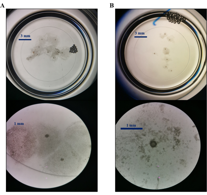 figure-results-3 Petri dish microbial growth patterns, microscopy image, 3 mm and 1 mm scale, sample analysis.