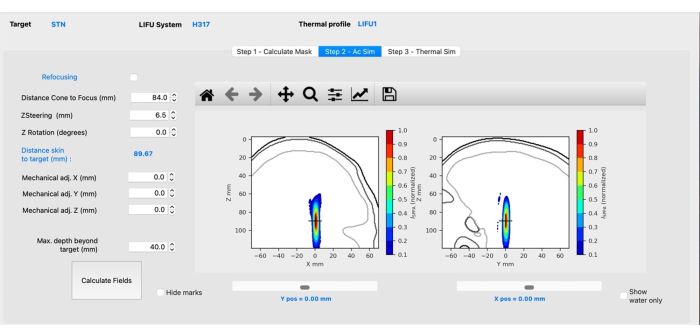LIFU simulation refocusing diagram; thermal profile, X, Y axis, focus adjustments, acoustic field.