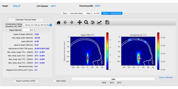 Thermal simulation analysis; brain ultrasound; Isppa; temperature; diagram; data visualization.