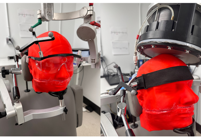 Stereotactic head frame setup for precise imaging and treatment alignment, seen in experimental lab.