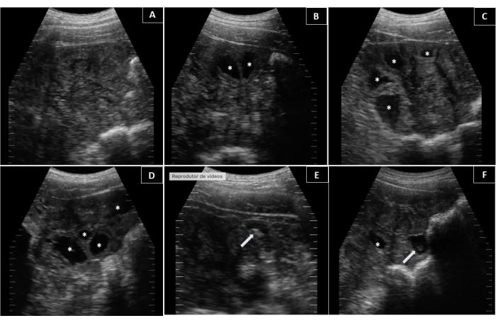 figure-results-1 Sequenza ecografica, analisi della struttura renale, imaging medico, procedura diagnostica, studio renale.
