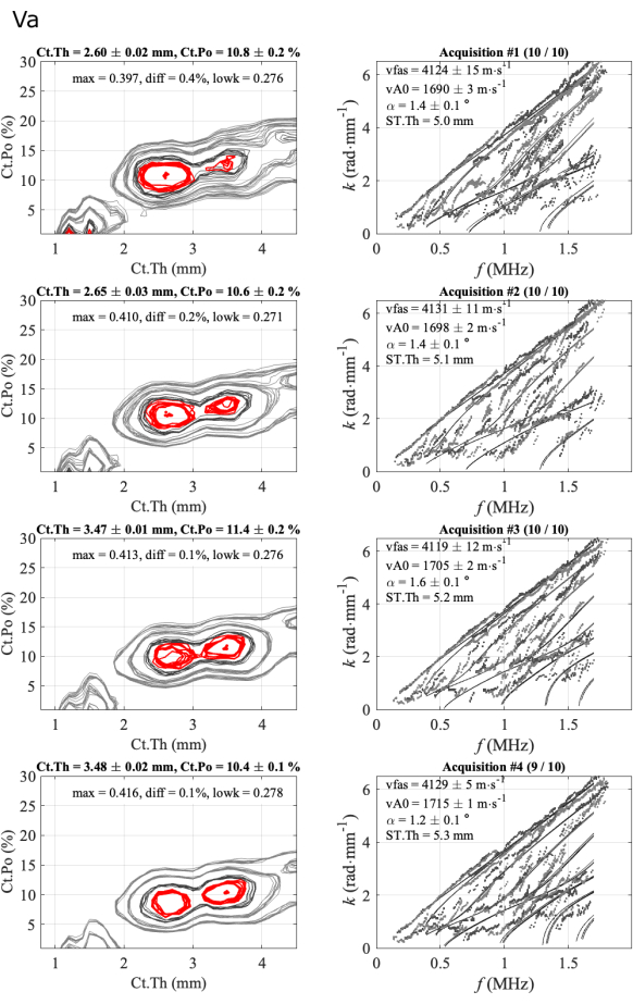 Bone density contour and frequency analysis charts; cortical thickness vs porosity; ultrasound data.