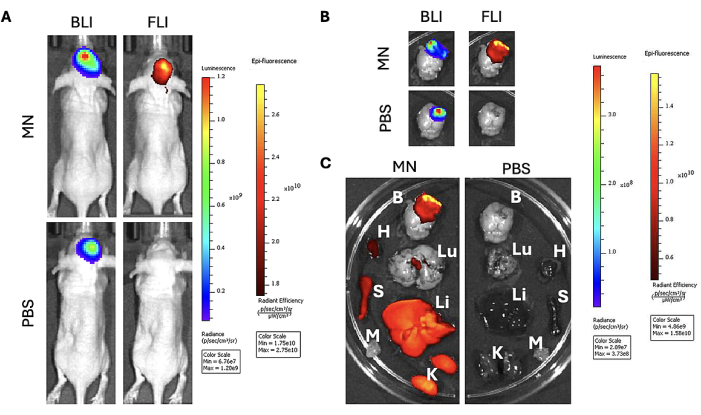 Bioluminescence and fluorescence imaging in mice; comparative analysis, MN vs. PBS treatments.