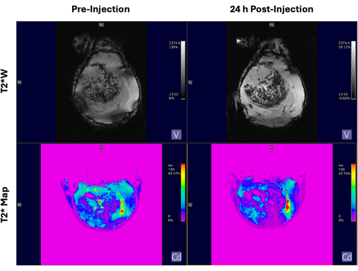 MRI analysis of pre and post-injection T2*W and T2* Map images, showing contrast-enhanced regions.
