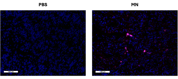 Fluorescence microscopy comparison; PBS vs MN; cell viability study; 100 µm scale bar.