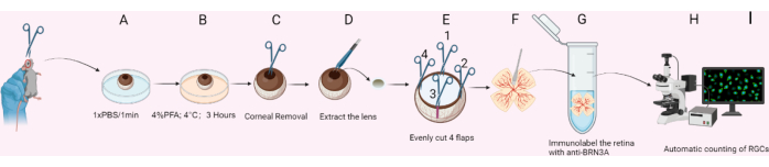 Retina processing diagram with immunolabeling and automatic RGC counting via microscopy.