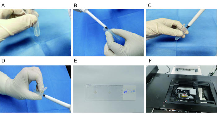 Cell sample preparation for microscopy; includes slide preparation, pipetting, index image.