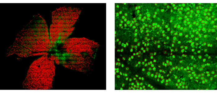 Fluorescence microscopy images showing protein localization in plant cells; cellular GFP expression.