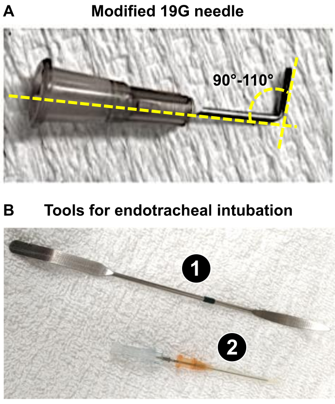 Modified 19G needle and intubation tools; 90-110° angle; medical procedure setup.