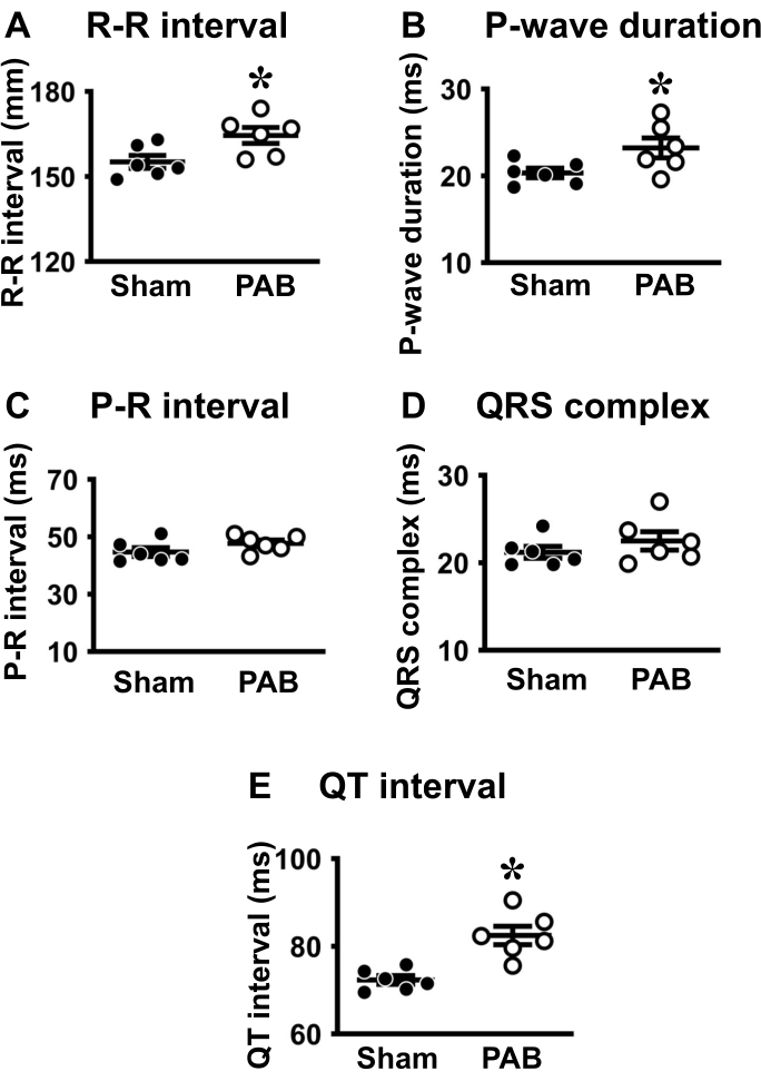 figure-results-4 ECG analysis charts; R-R, P-wave, P-R, QRS complex, QT intervals; Sham vs PAB group comparison.