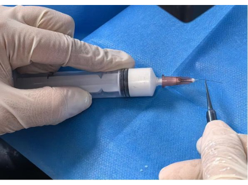 figure-results-2 Syringe needle insertion; medical procedure demonstration with precision technique.
