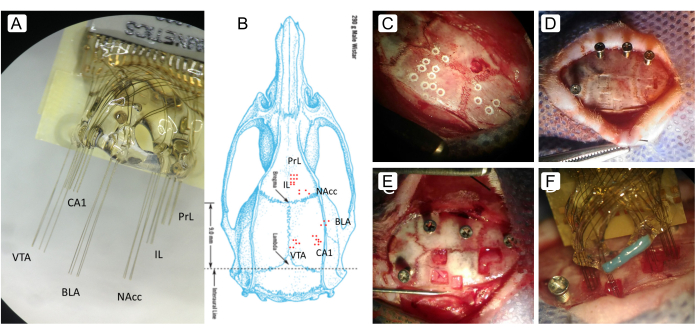 Brain region targeting with electrode array; placement diagram and surgical images in neuroscience research.