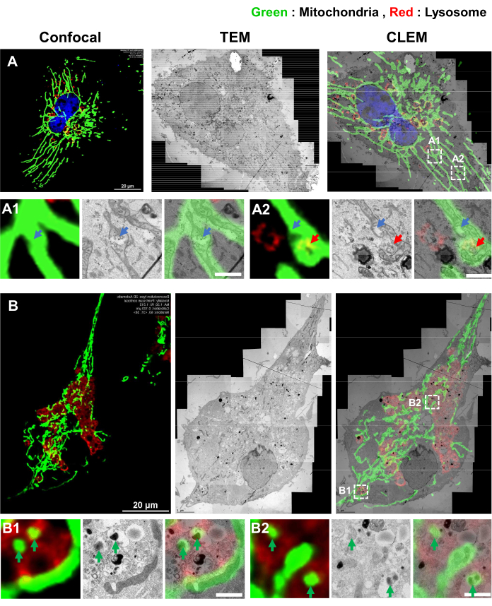 figure-results-3 Confocal, TEM, and CLEM image of mitochondria (green) and lysosomes (red); cellular component analysis.