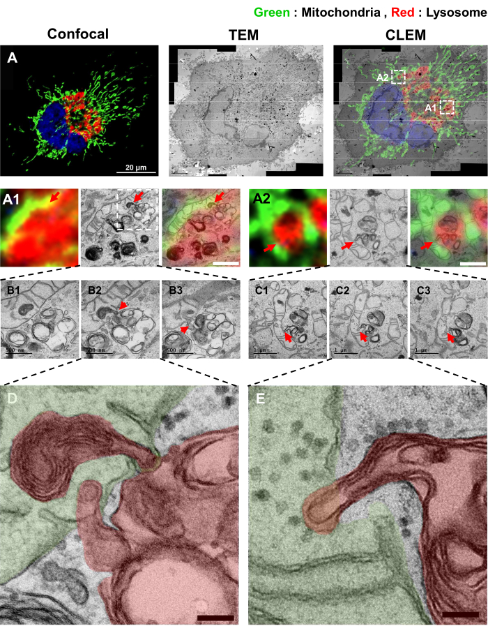figure-results-4 Confocal, TEM, CLEM diagram of mitochondria-lysosome interaction, highlighting cellular features.
