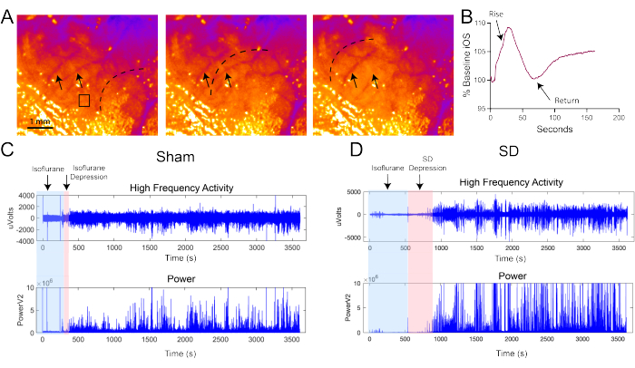 figure-results-2 Cerebral imaging sequences with IOS graph, EEG data; study on isoflurane effects and depression.