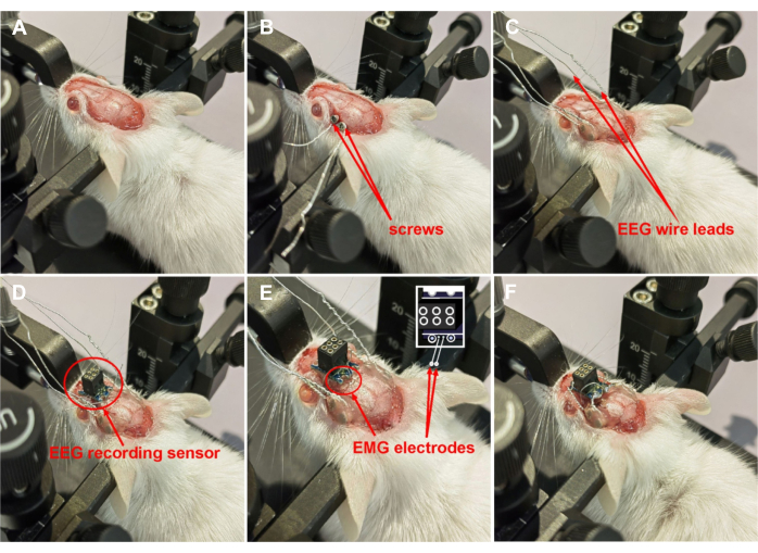Mouse EEG/EMG setup diagram showing electrode placement and signal recording process for brain study.