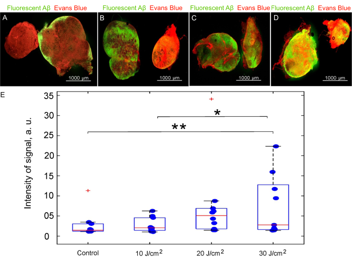 Fluorescent Aβ and Evans Blue staining in tissue samples, box plot showing signal intensity variation.