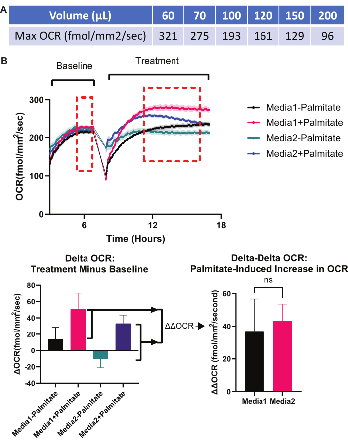 OCR analysis with palmitate treatment; graphs showing OCR changes, media comparison, ΔΔOCR chart.