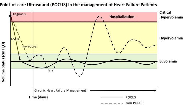 POCUS in heart failure; diagram shows volume vs. time, comparing POCUS and non-POCUS management.