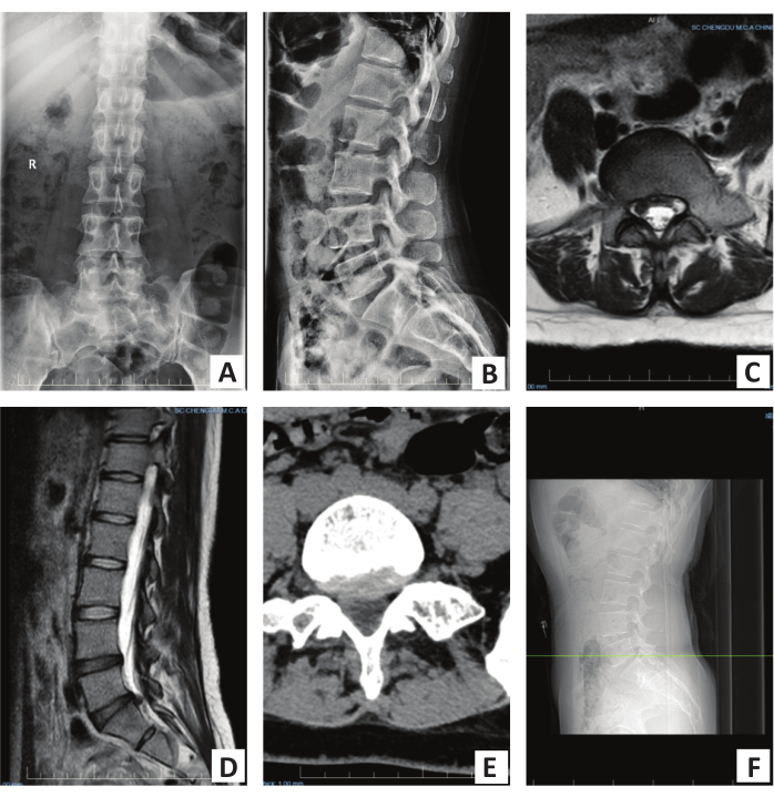 Spinal anatomy imaging, X-ray and MRI scans, vertebral structure analysis, medical diagnostics.