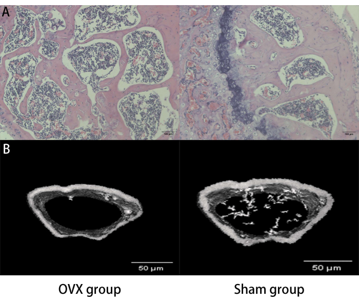 Histological analysis of bone structure; microscopy images comparing OVX and sham groups.