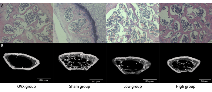 Bone tissue microscopy images and structural analysis in OVX, Sham, Low, and High groups; μCT results.