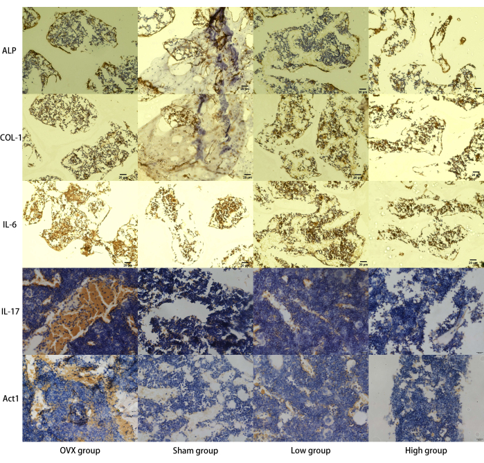 Histological staining analysis; ALP, COL-1, IL-6, IL-17 markers in OVX, Sham, Low, High groups.