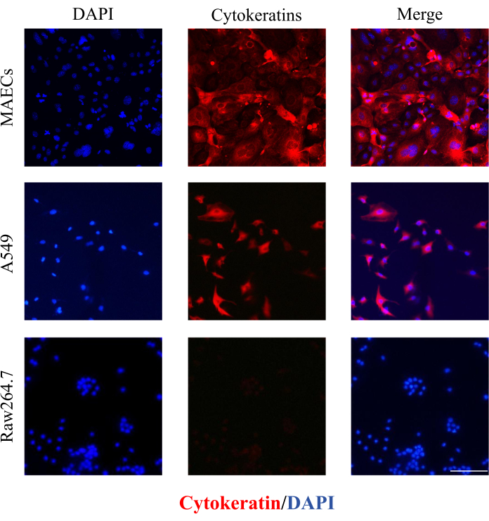 Fluorescence microscopy images of DAPI-stained nuclei and cytokeratin expression in cell lines.